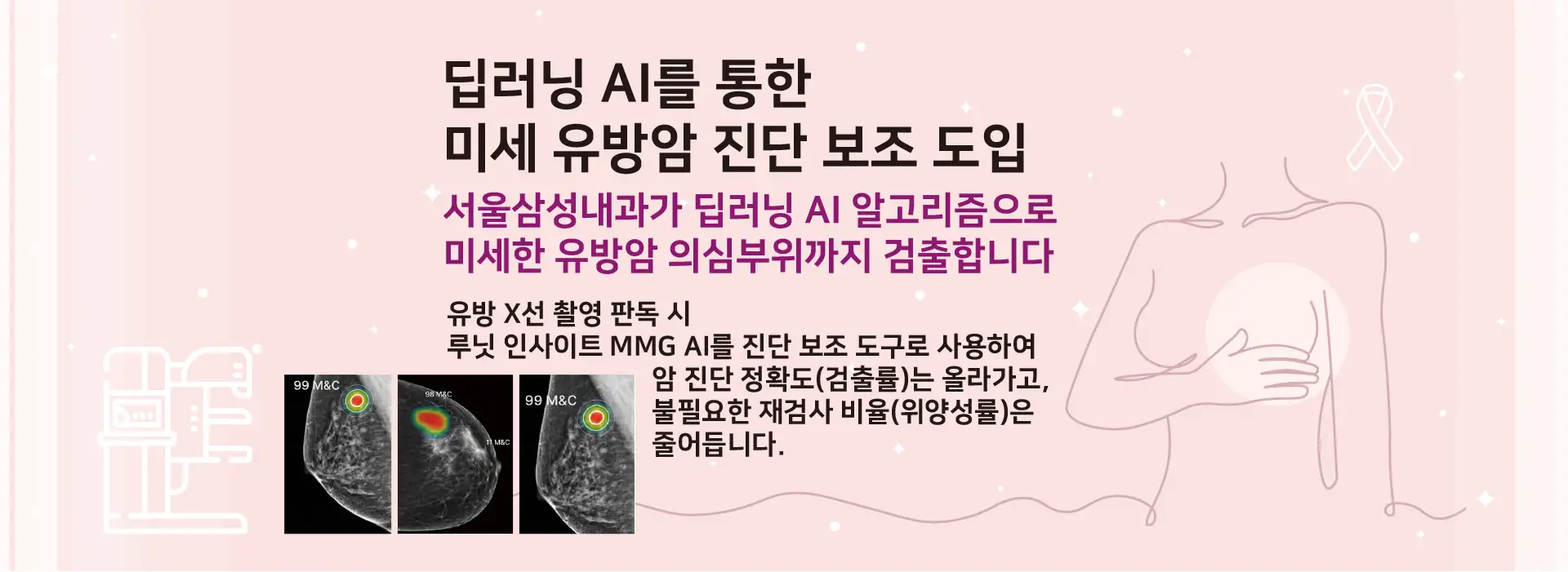 AI 미세 유방암 검진 진단 보조 도입