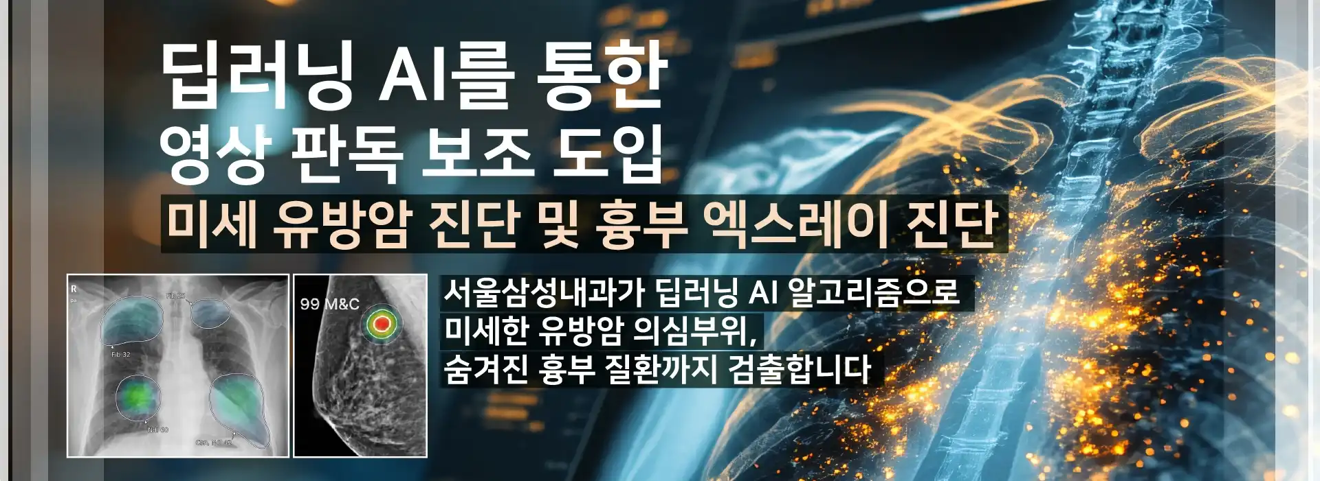 AI 미세 유방암 검진 진단 및 흉부 엑스레이 촬영 진단 보조 도입